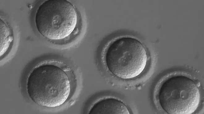 Image: In Breakthrough, Scientists Edit a Dangerous Mutation From Genes in Human Embryos