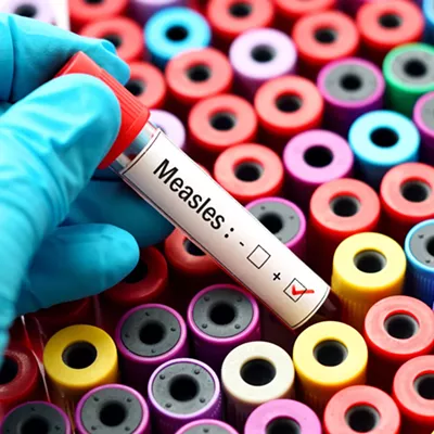 Image: Inland Northwest measles cases raise concerns about undetected community spread and vaccine disinformation