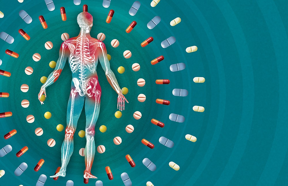 Taming the Pain: How to manage chronic pain without the use of addictive opiates
