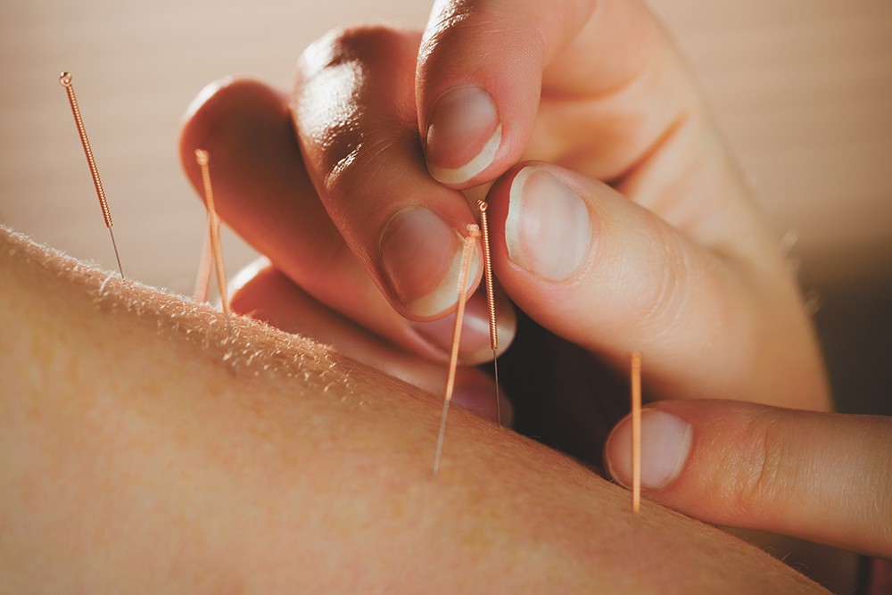 Can acupuncture help prevent opioid overuse and addiction?