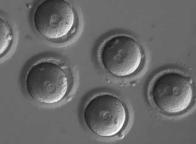 In Breakthrough, Scientists Edit a Dangerous Mutation From Genes in Human Embryos