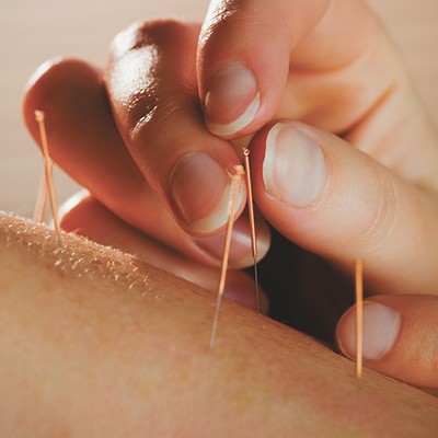 Can acupuncture help prevent opioid overuse and addiction?